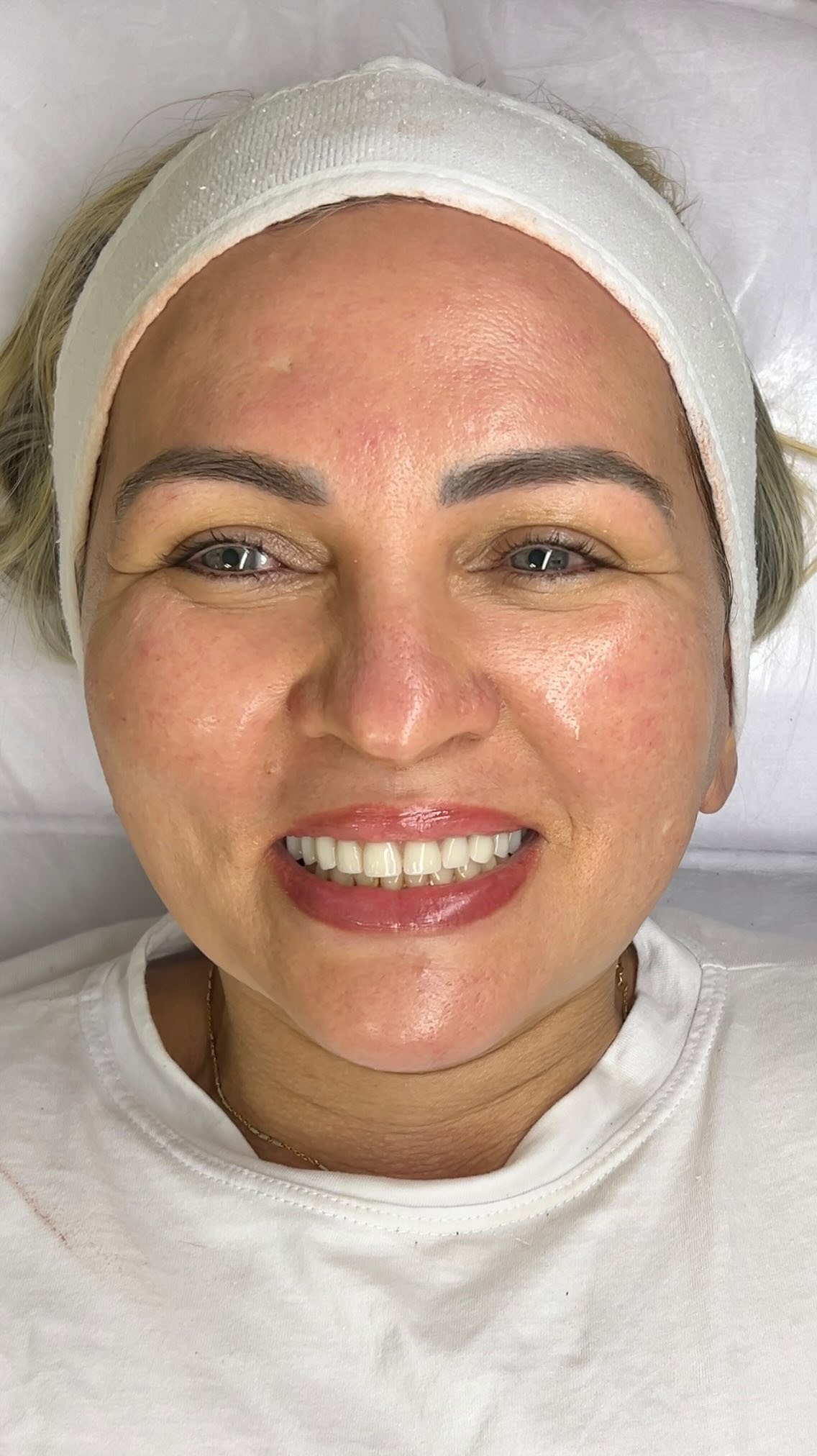 Meu trabalho é cuidar… e eu amo fazer isso 🤍✨

#EsteticaAvancada #EsteticaFacial #CuidadosComAPele
#PeleSaudavel #limpezadepele